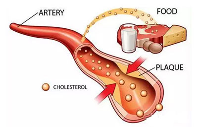 美国膳食指南“胆固醇”的部分,到底如何解读?